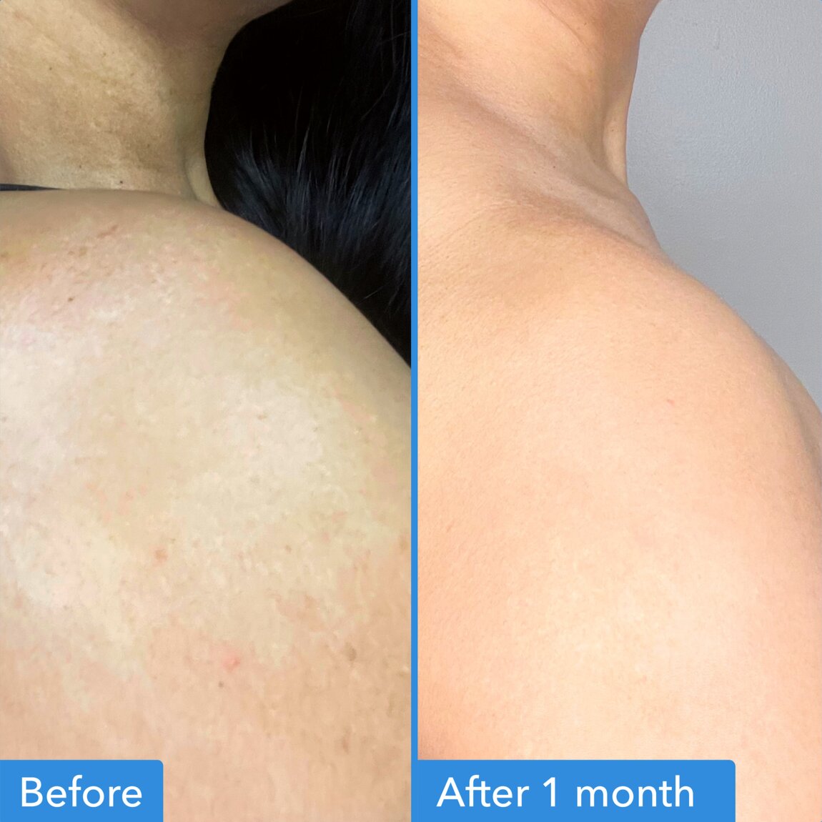 discoloration-correcting-body-treatment-s4 zb_p.jpg