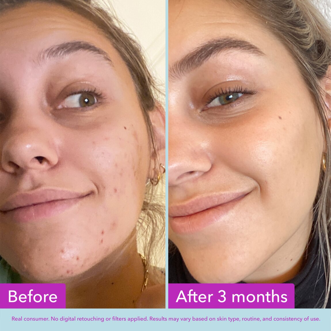 niacinamide-brightening-toner-p1 zb_p.jpg