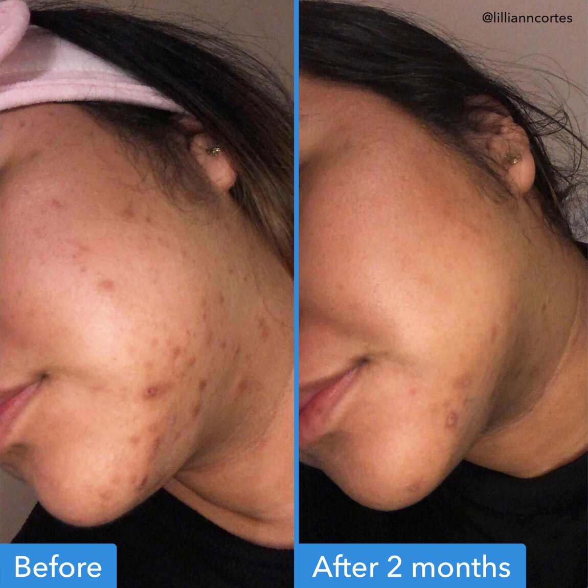 discoloration-correcting-serum-c5 zb_p.jpg